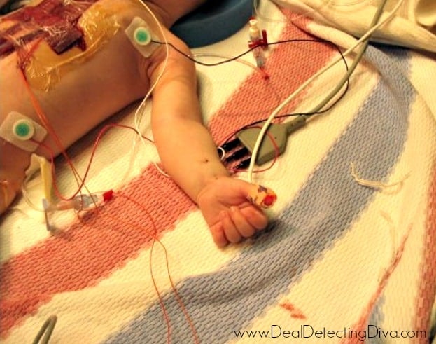 Baby post heart surgery and hooked up to medical monitors.